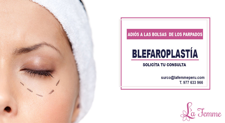Blefaroplastía